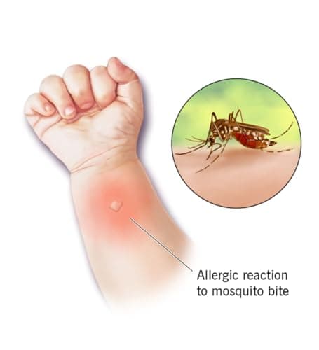 Mosquito & Insect Repellent Spray Pen Bugs, Horse Flies, Wasps Reduce Inflammation Provides Quick Repellent from Insect Bites and Sting Swelling, Ideal for Outdoor Holiday Activities 2 PCS — view 2
