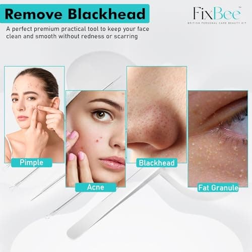 Blackhead Remover Tool - Pimple Popping Kit - Whiteheads, Acne Comedone Extractor, Milia Remover, Pimple Popper, Black Head Remove Tools Set with Face Blackhead Remover Tweezer - 5PC Spot Popping Kit — view 3