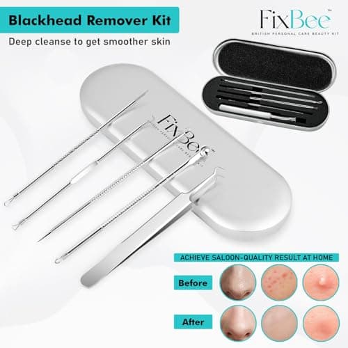 Blackhead Remover Tool - Pimple Popping Kit - Whiteheads, Acne Comedone Extractor, Milia Remover, Pimple Popper, Black Head Remove Tools Set with Face Blackhead Remover Tweezer - 5PC Spot Popping Kit — view 2