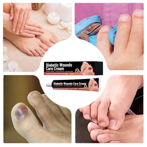 Cracked Heel Cream Soothing Deep Moisturizing Portable 20g — view 4