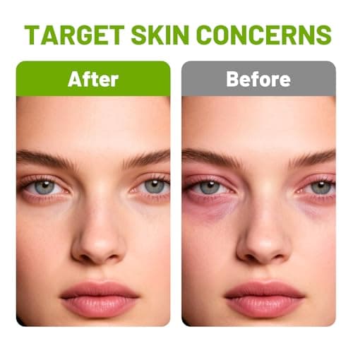 3PCS Retinal Shot Tightening Booster Set, 1 Retinol Skin Booster Serum 30ml, 1 Retinol Eye Creams 15ml and 1 Gua Sha Tools, For Travel And Daily Home Care, For All Skin Types — view 4