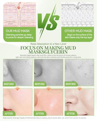 Clay Face Mask Kit-12Pcs Cucumber Clean Clay Facial Masks Set for Women — view 4