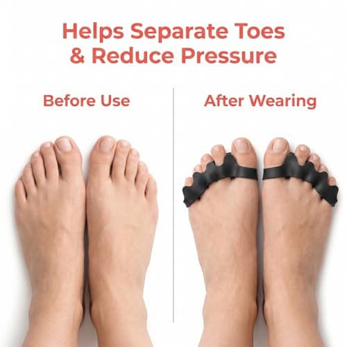 2 Pairs/4 Pcs Toe Separators for Overlapping Toes (Black) — view 4