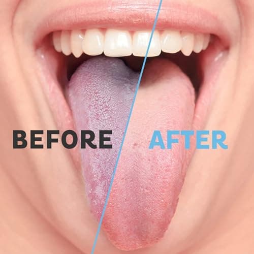 Kinmira Tongue Scraper (Pack of 1) - Stainless Steel Metal U-Shape Tongue Cleaner with Travel Pouch - Designed in London - Eco-Friendly Plastic-Free Packaging - Dental Hygiene & Fresh Breath — view 3