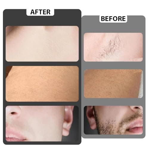 Manual Razor for Men Women, YiYunTE Beard Razor Shavers for Bikini Armpit Leg Hair, Reusable Face Eyebrow Shaving Razor Kit, Durable Stainless Steel Hair Removal Tool Safety Razors Gift for Travel — view 4
