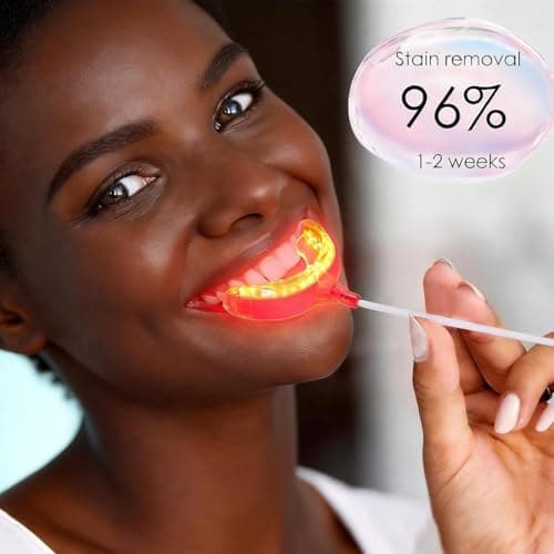 Oral Care Device for Gums – 16 LED Gum Comfort Support, Light Oral Hygiene Tool with USB/USB-C/iPhone/Android Adapters, No Batteries Needed, Soft Silicone Mouth Tray for Daily Use — view 6