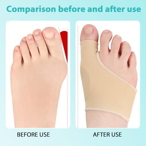 Hallux Valgus Socks L Size with Anti Slip Strips Toe Support Foot Care — view 4