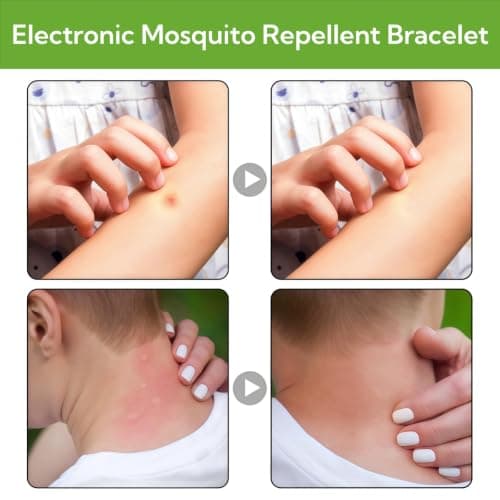 Ultrasonic Mosquito Repellent Bracelet,Electronic Insect Repellent Watch — view 2