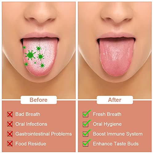 ACWOO Tongue Scraper, 3 Pack Stainless Steel Tongue Cleaners with Travel Case, Tongue Cleaner Tool for Oral Hygiene, Fresh Breath, and Reduce Bad Breath, Reusable Tongue Scrapers for Adults — view 3