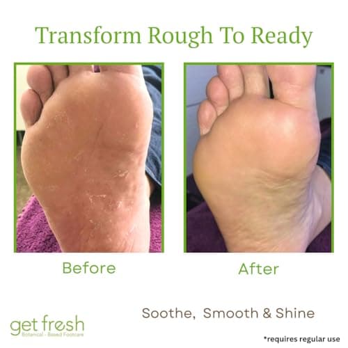 Intensive Foot Repair Cream For Cracked Heels And Dry Skin by Get Fresh Rescue Me Foot Moisturiser, Heel Balm for Callouses and Hard Skin Refreshing Lemongrass Travel Size 56g — view 3