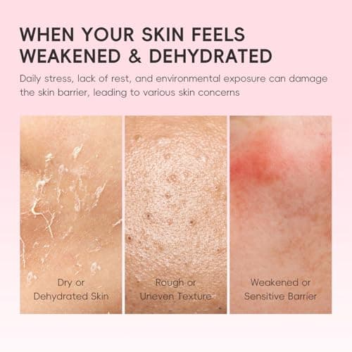 Skin Care For Teenage Girls,Sakura Skincare Set (Sakura-5PCS) — view 4