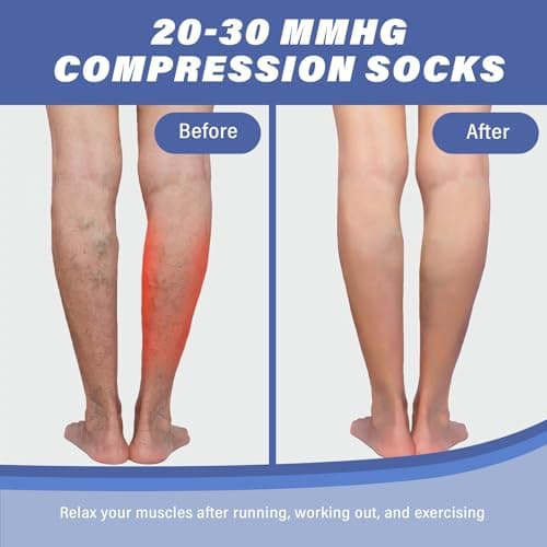 Sahunfri 2 Pairs Open Toe Compression Socks Women Men, 20-30 mmHg Flight Compression Socks for Women, Toeless Pressure Socks for Calf Support(UK, Alpha, L, XL, Regular, Regular, Nude&Black) — view 4