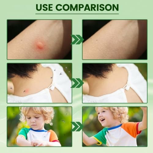 Purple Grass Insect Bite Re/lief Stick,Bite Cream for Mosquito,Outdoor Use — view 2