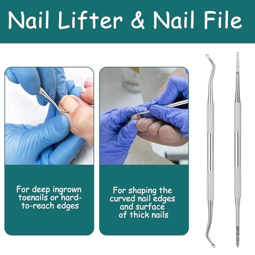 xiluuyou 10 Pcs Ingrown Toenail Tool Pedicure Tool Kit — view 4