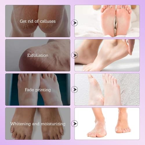 5 Pairs Foot Peel Mask for Hard Skin, Dead Skin Remover for Feet, Exfoliating Foot Mask with Lavender, Moisturising Socks to Repair Cracked Heels & Calluses, Hydrating for Soft Smooth Feet — view 5