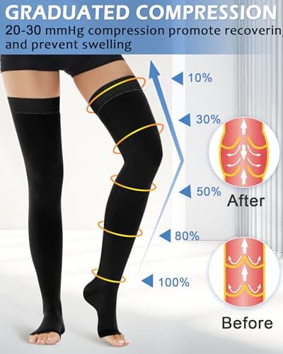 Ailaka 20-30 mmHg Compression Stockings for Women Men, Thigh High Open Toe — view 2