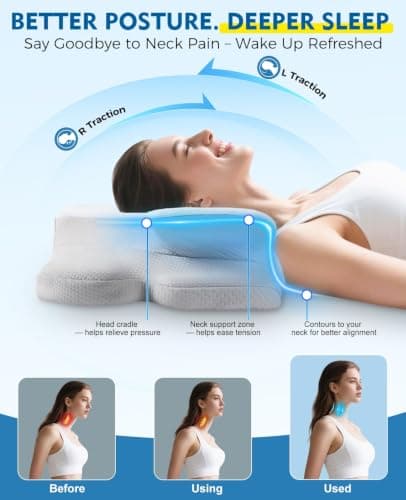 Drifina Orthopaedic Neck Support Pillow for Side Sleepers, Cervical Memory Foam Pillow for Neck & Shoulder Pain Relief, Dual-Height Ergonomic Bed Pillow, Cooling Washable Cover, 100-Night Trial，White — view 2