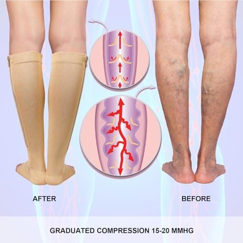 QKURT 2 Pairs Medical Compression Socks, Open Toe Calf Socks Knee High Calf Compression Socks 15-20 mmhg Compression Sports Health Socks with Zipper for Women Men — view 5