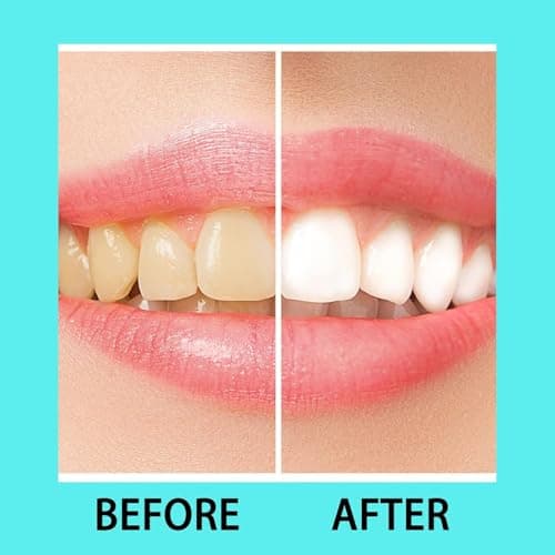 Oral Care Device for Gums – 16 LED Gum Comfort Support, Light Oral Hygiene Tool with USB/USB-C/iPhone/Android Adapters, No Batteries Needed, Soft Silicone Mouth Tray for Daily Use — view 3