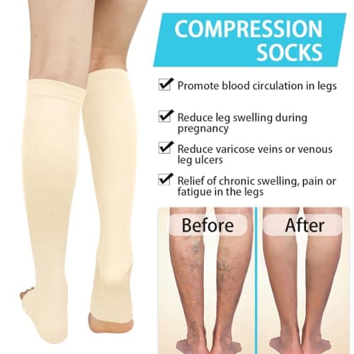 ACWOO Compression Socks for Women & Men, 2 Pairs Open Toe Graduated Stockings Support, Non-Slip Flight Socks Running Socks for Sports, Flying, Maternity Pregnancy, Nurses, Travel, Running — view 4