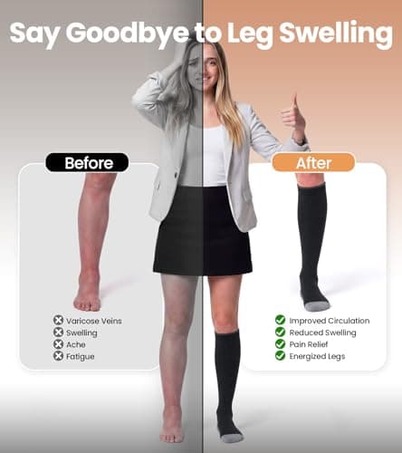 RUIXUE Compression Socks for Women and Men, 20-30 mmHg Cooling Flight Socks, 2 Pairs Graduated Socks for Travel, Sport, Nurse, Long Sitting(Swelling & Aches Relief), Black, S-M — view 6
