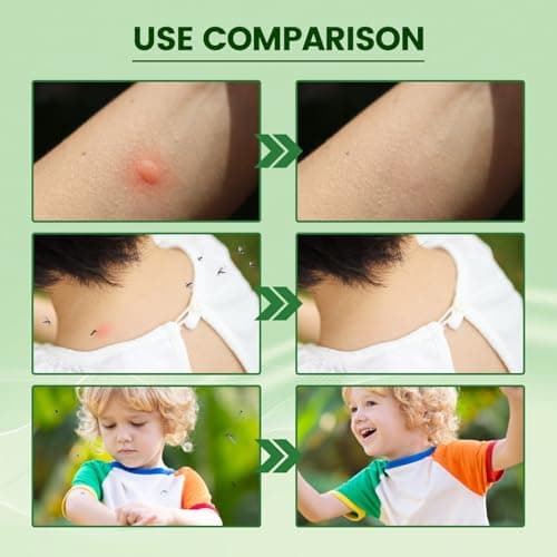 Purple Grass Mosquito Bite Relief Stick & Bite Cream, Dual-Action Insect Bite Relief for Itchy Skin, Sooth and Repel Mosquito Bites, Portable Essential On-The-Go Outdoor Travel Bite Relief Stick — view 2