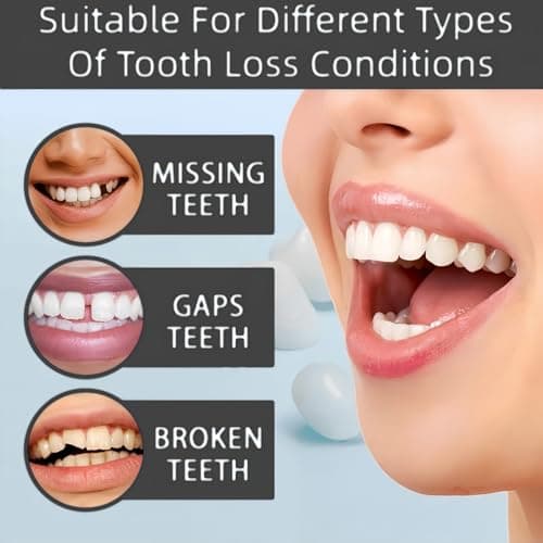 2pcs Soft Denture Silicone Reline Kit,False Teeth Set for Women and Men,Full Mouth Temporary Dentures,Easy to Use,Wide Application,Portable Design,Premium Materials,Soft and Comfortable Design — view 4