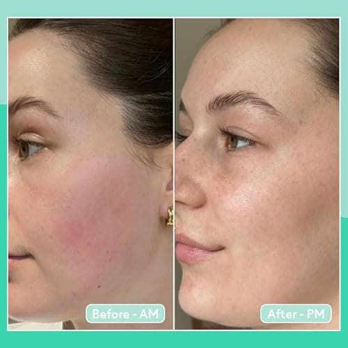Q+A Cica Overnight Face Mask 50g, Sensitive Skin Sleeping Mask — view 6