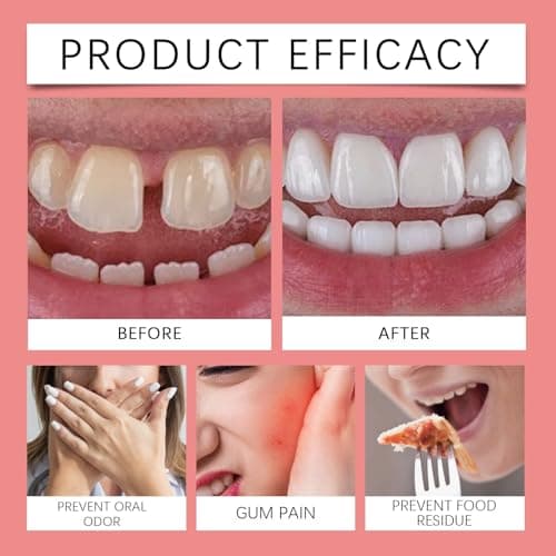 Thermoplastic Denture Adhesive Cream, Teeth Filling Repair Kit, Dental Glue for Teeth, De/nture Silicone Reline K/it,Secure Den/ture Adhesive,Dentu/re Repair,De/nture Adh/esive#White — view 2