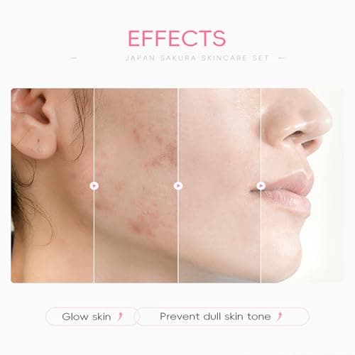 Skincare Set Girls Gift,Skin Care For Teenage Girls (Cherry Blossoms-28PCS) — view 6