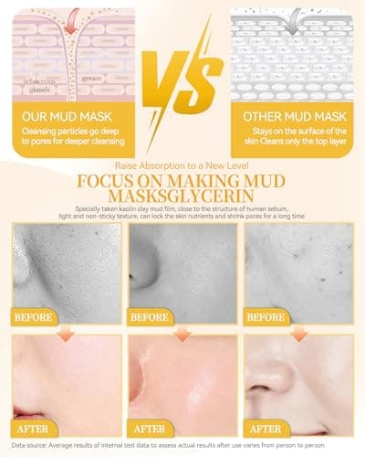 Clay Face Mask Kit-12Pcs Vitamin C Clean Clay Facial Masks Set for Women — view 4