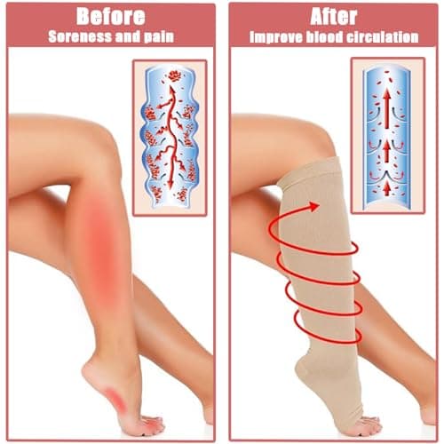 2 Pairs Compression Socks for Women and Men, Open Toe Graduated Stockings Support Non-Slip Breathable Pressure Socks for Sports, Flying, Shin Splints, Travel, Running (S-M) — view 5