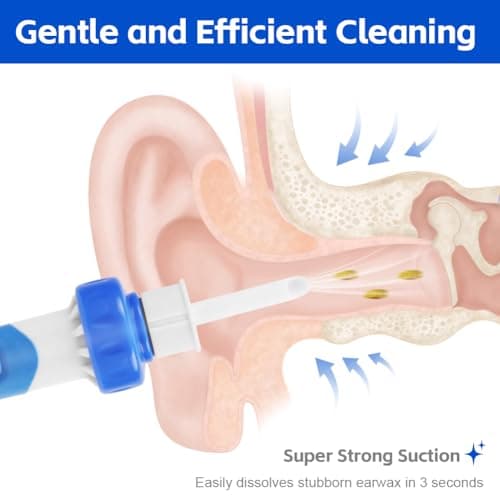 LOPHE Electric Ear Cleaner, Soft Earwax Cleaner for Kids & Adults Earwax Remover Tool with Replaceable Tip Ear Wax Cleaner Ear Cleaning Kit with Replaceable Tip for Adults and Children — view 5