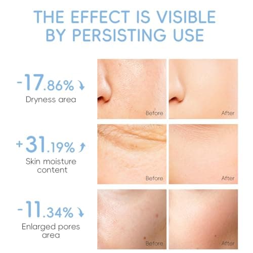Milk Skin Care Sets & Kits - Milk Beauty Gift Sets for Teenage Girls - Teenage Girls Gifts - Facial Kits for Women - Travel Skincare Set Daily Face Care - Deep Hydrating Smoothing 28PCS (Milk-28PCS) — view 5