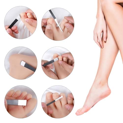 MBAIYO 6 Pack Ingrown Toenail Removal Kit, Professional Pedicure Tools for Ingrown Toenail Callus Shaver Corn Removers for Toes Stainless Steel Nail Knives Kit with Storage Box — view 2