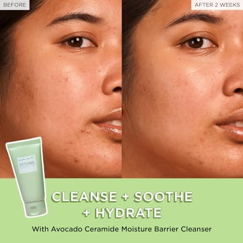 Glow Recipe Fruit Babies Skincare Kit - Gift Set with Ceramide Facial Cleanser + BHA Toner + Vitamin C Eye Cream + Hyaluronic Acid Cream + Niacinamide Dew Drops (5 Count) — view 3