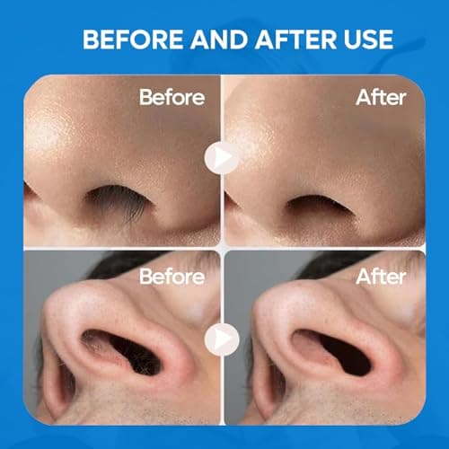 ZL-HOME Nose Hair Trimmer, 2-in-1 Nasal Hair Cutter, Portable, 360° Rotating, Manual, Unisex-Adults, Men, Women, Travelers, All Ages — view 4