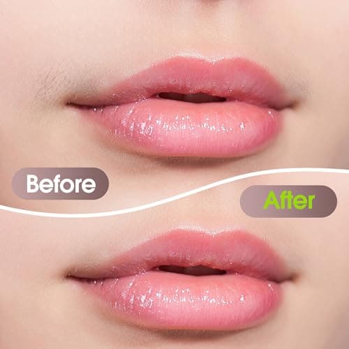 Facial Hair Removal for Women: Electric Hair Removal Device - Rechargeable Painless face Razor for Chin Upper Lip Peach Fuzz with Light (Rose Gold) — view 3