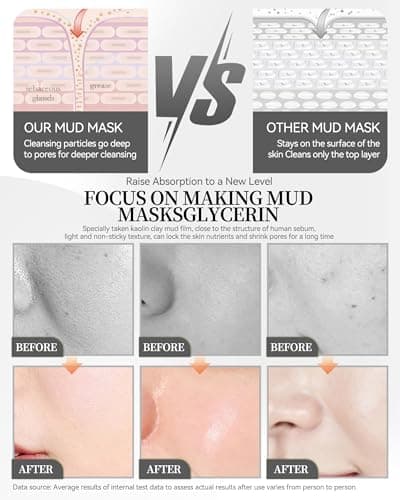 Clay Face Mask Kit-12Pcs Dead Sea Mud Clean Clay Facial Mask Set for Women — view 4