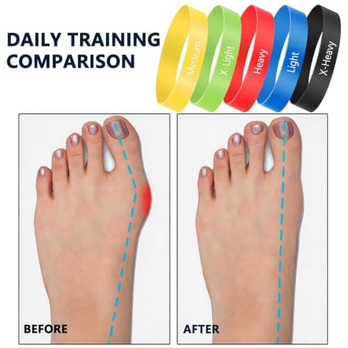 5 Pack Toe Exercise Bands, TPE Toe Strap with Multi Resistance for Bunion Support, Toe Stretch Bands for Foot Strengthener Training, Home Workout, Travel Use with Storage Bag Included — view 4