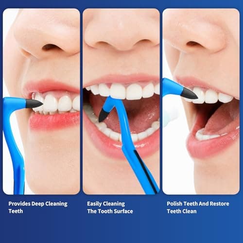 Annhua Tooth Stain Eraser and Remover Tool, 2 PCS Manual Surface Stain Cleaner for Teeth with Non-Slip Handle, Personal Oral Care Kit for Home and Travel - Blue and White — view 6