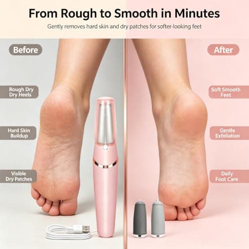 Electric Rechargeable Callus Remover Foot File with 2 Grinding Heads — view 2