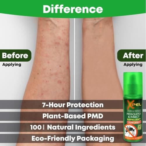 Mosquito & Insect Repellent Spray 70ml – 3 Pack | After Bite Cooling Spray for Bites & Stings | Anti-Itch, Fast-Absorbing Formula | Skin Safe Protection from Flying Insects — view 2