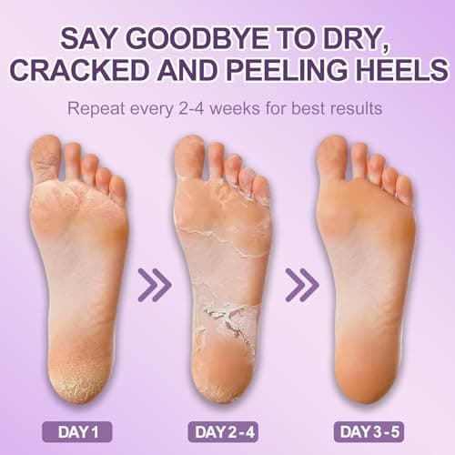 5 Pairs Foot Peel Mask for Hard Skin, Dead Skin Remover for Feet, Exfoliating Foot Mask with Lavender, Moisturising Socks to Repair Cracked Heels & Calluses, Hydrating for Soft Smooth Feet — view 4
