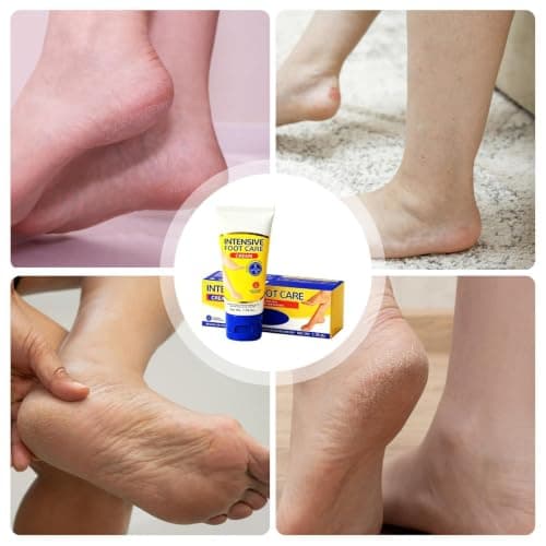 Foot Cream Natural Non-Greasy Softening Moisturizing Balm — view 4