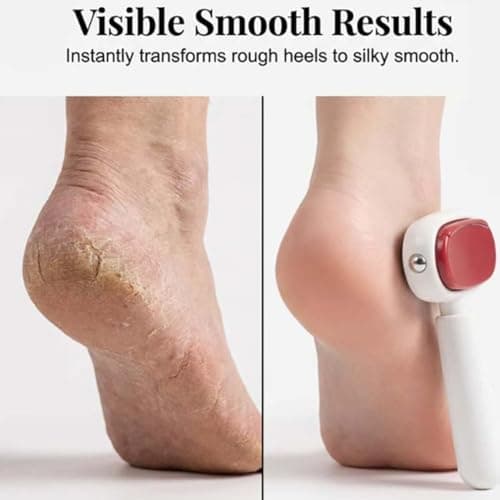 2PCS Double-Sided Foot Scraper for Callus Removal — view 5