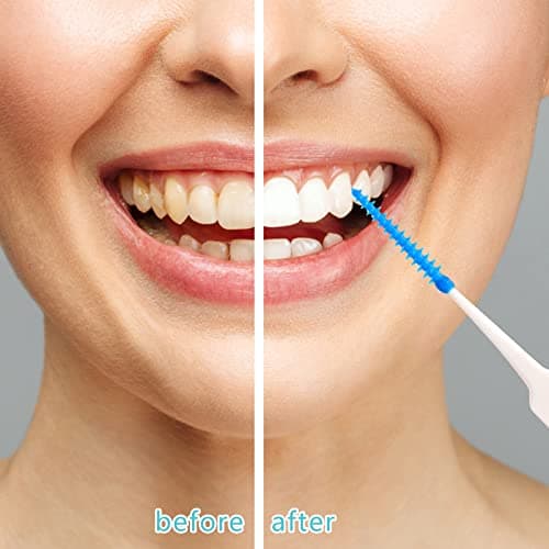 RAYITO 100 Pieces Dual-Use Interdental Brushes — view 6