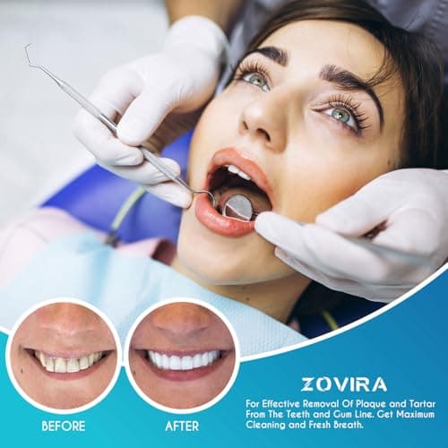 ZOVIRA Plaque Remover for Teeth 4pc Tooth Cleaning Kit with Tartar and Calculus Removal Dental Care Set Stainless Steel Dentist Tools for Personal and Home Use — view 4