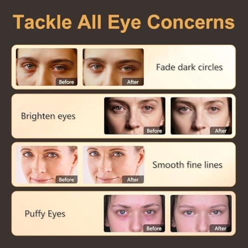 60pcs Under Eye Mask, 24K Gold Eye Mask, Collagen Hydrating Gel Pads, Reducing Dark Circles, Moisturizing, Puffiness and Eyes Bags, Anti-Wrinkle, Hydrating — view 4