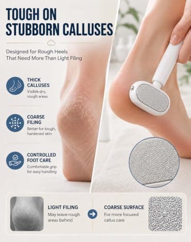 Double-Sided Foot Scraper for Callus Removal — view 3